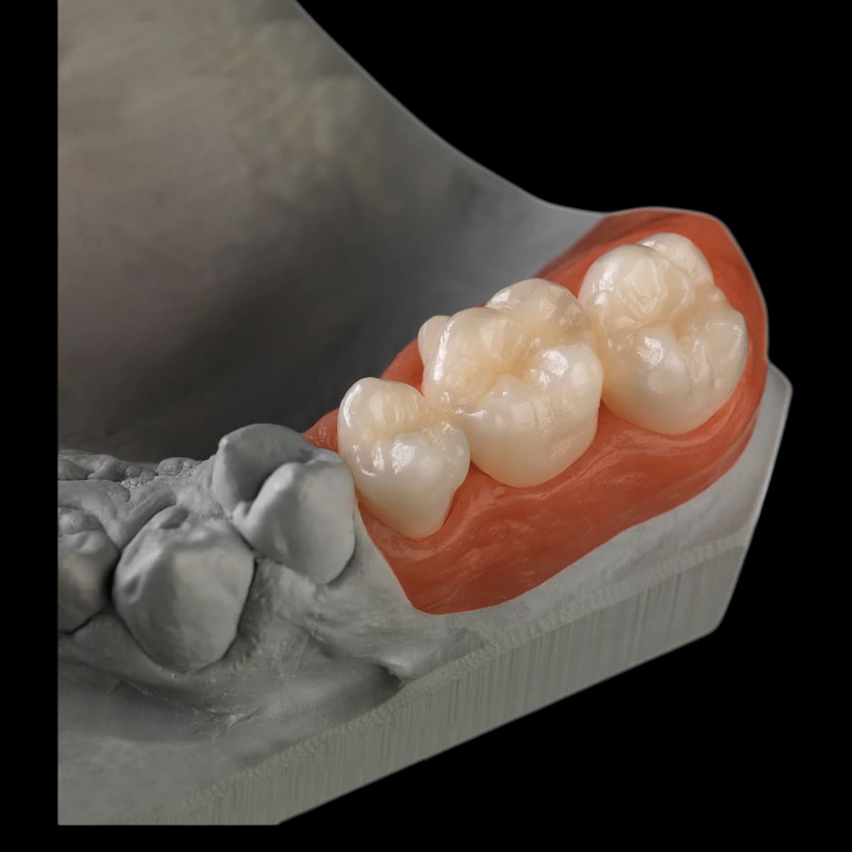 Ceramill Zolid FX Multilayer Zirconia Disc, Shade 0/A1, 98 x 16 mm, F, 1 Disc thumbnail 2