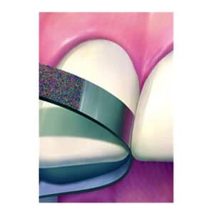 NTI Diamond Finishing Strips, Narrow, 2.5 mm Wide, Fine (Red), 10/Pk, FS2-F thumbnail 10