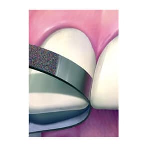 Kerr NTI Diamond Finishing Strips, Narrow, 2.5mm Wide, 0.10mm Thick, Medium (Blue), 10/Pk, FS2-M thumbnail 11