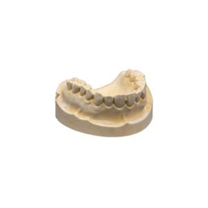 Microstone Golden Type III Dental Stone, 140g Packets, 80/Box, 02364 thumbnail 7