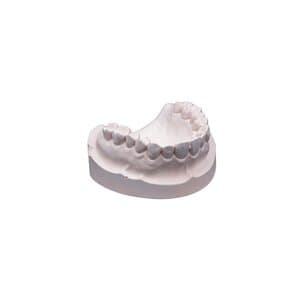 Whip Mix Snap-Stone Type IV Fast-Setting Dental Stone, Pink, 11 lb (5 kg), 23690 thumbnail 7