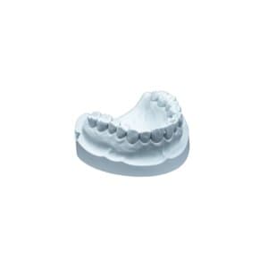 Whip Mix Hard Rock Aqua Die Stone, ISO Type 5, 33 lb (15 kg) Carton, #330001 thumbnail 6
