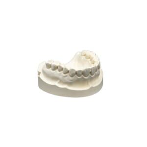 Whip Mix Silky-Rock Ivory Type 4 Low Expansion Die Stone, 33 lb (15 kg) Carton, 330023 thumbnail 6