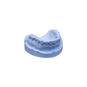 Whip Mix Quickstone Laboratory Stone, ISO Type 3, Blue, 33 lb Carton (330061) thumbnail 6