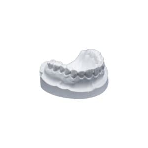 Whip Mix Mounting Plaster, White, Fast Set, ISO Type 1, 33 lb Carton (15 kg), #330090 thumbnail 6