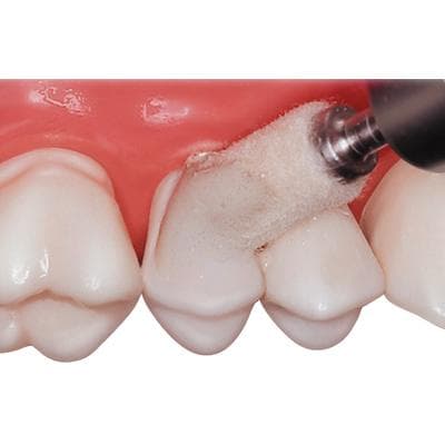 Luminescence Single-Step Diamond Polishing System, Intro Kit, 3 g Syringe Gel, 2 RA Mandrels, 50 Applicators, 2014200 thumbnail 9
