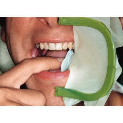 Hager Worldwide Plast-Frame Rubber Dam Frame, Green, Autoclavable Plastic, 355319 thumbnail 4