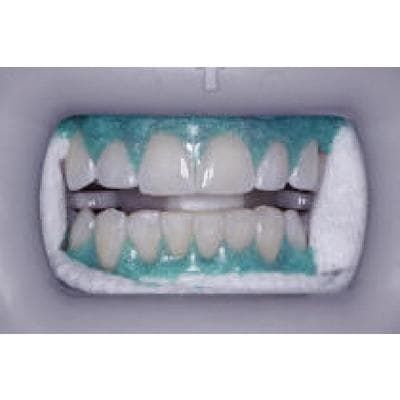 Venus White Max Light Cure Gingival Barrier, 38% Hydrogen Peroxide, 1.2 ml Syringes, 4/Pk, 40005202 thumbnail 12