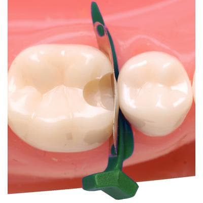 FenderMate® Left Regular Sectional Matrix & Wedge, Dark Green, Refill, 18/Pkg, 602771 thumbnail 14