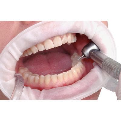 OptraGate ExtraSoft 3D Lip and Cheek Retractor Refill, Junior, White, 80/Pkg, 591451WW thumbnail 11