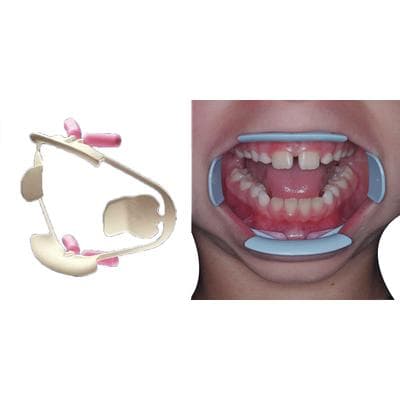 ComfortView Lip & Cheek Retractor, Universal, White, 2/Box, 9061381 thumbnail 18