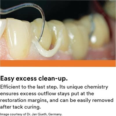 3M RelyX Universal Resin Cement Trial Kit, Shade A1, Dual-Cure, 3.4g Syringe, 56970 thumbnail 38