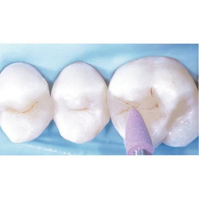 Venus Supra Pre-Polishers, Flame, Refill Pack of 10 thumbnail 5