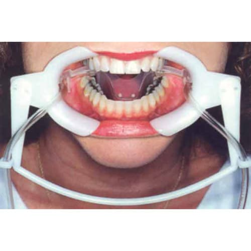 Nola Dry Field System, Large, White, Full Arch, with Silicone Tubing, 300-401 thumbnail 4