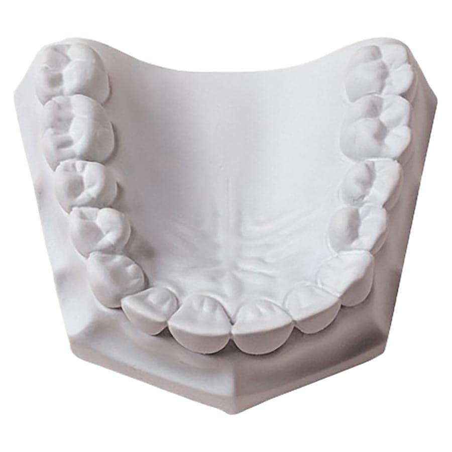 Whip Mix Mounting Stone, White, ISO Type 3, Fast Setting, 33 lb / 15 kg Carton, 330059 thumbnail 6