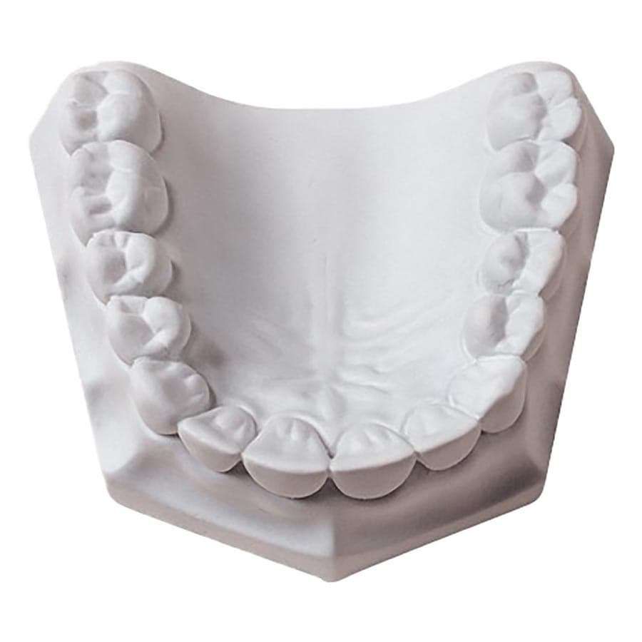 Whip Mix Orthodontic Plaster, Super White, ISO Type 2, 33 lb (15 kg) Carton, 330088 thumbnail 6