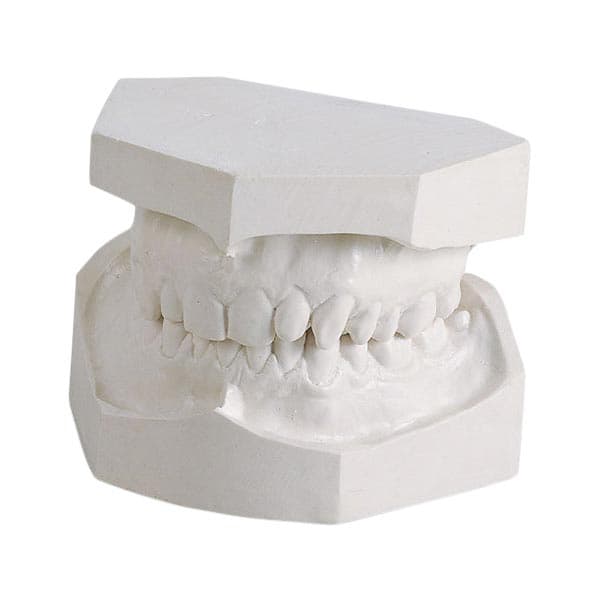 Kulzer Modern Materials O-67 Snow White Orthodontic Stone, Type III, 25 lb, 50046972 thumbnail 5