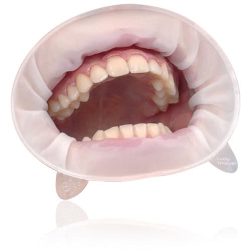 OptraGate ExtraSoft 3D Lip and Cheek Retractor Refill, Junior, White, 80/Pkg, 591451WW thumbnail 9