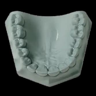 Whip Mix Hard Rock Aqua Die Stone, ISO Type 5, 33 lb (15 kg) Carton, #330001 thumbnail 2