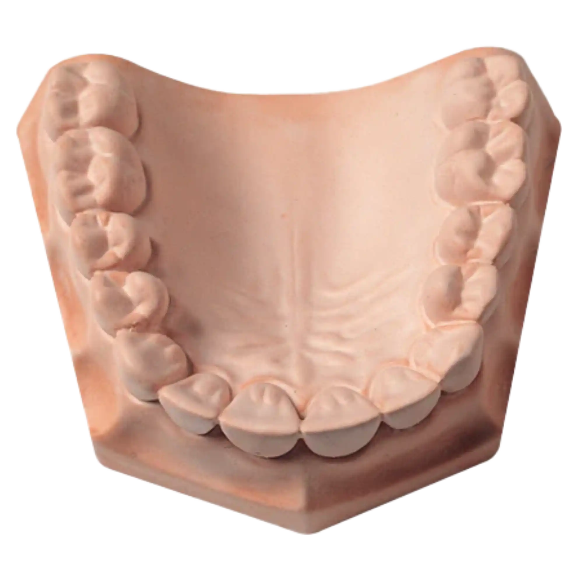 Whip Mix Snap-Stone Type IV Fast-Setting Dental Stone, Pink, 11 lb (5 kg), 23690 thumbnail 2
