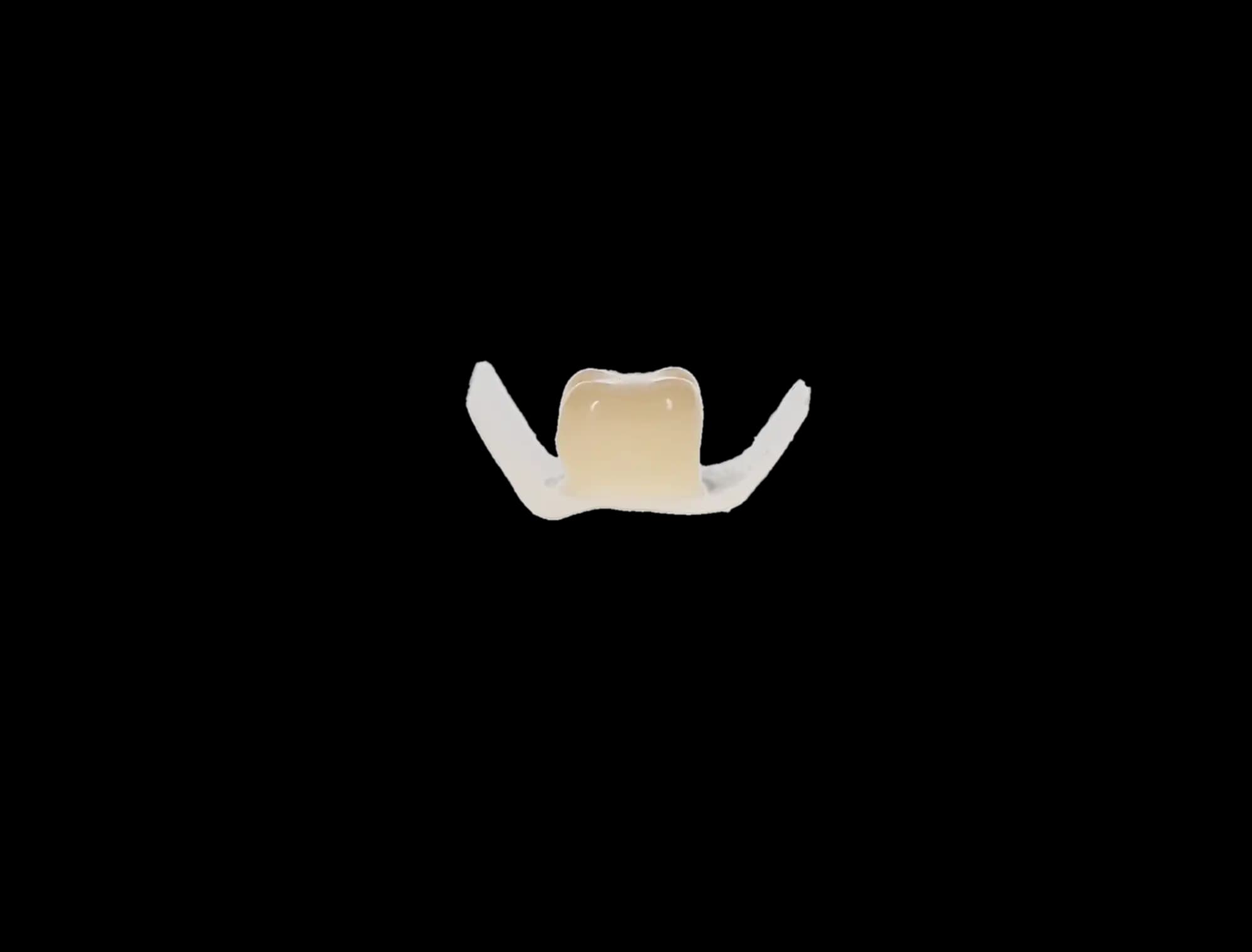 Protemp Crown Temporization Material, Adult Refill, Lower Large Molar, Universal Shade, 5/Pk, 50612 thumbnail 8