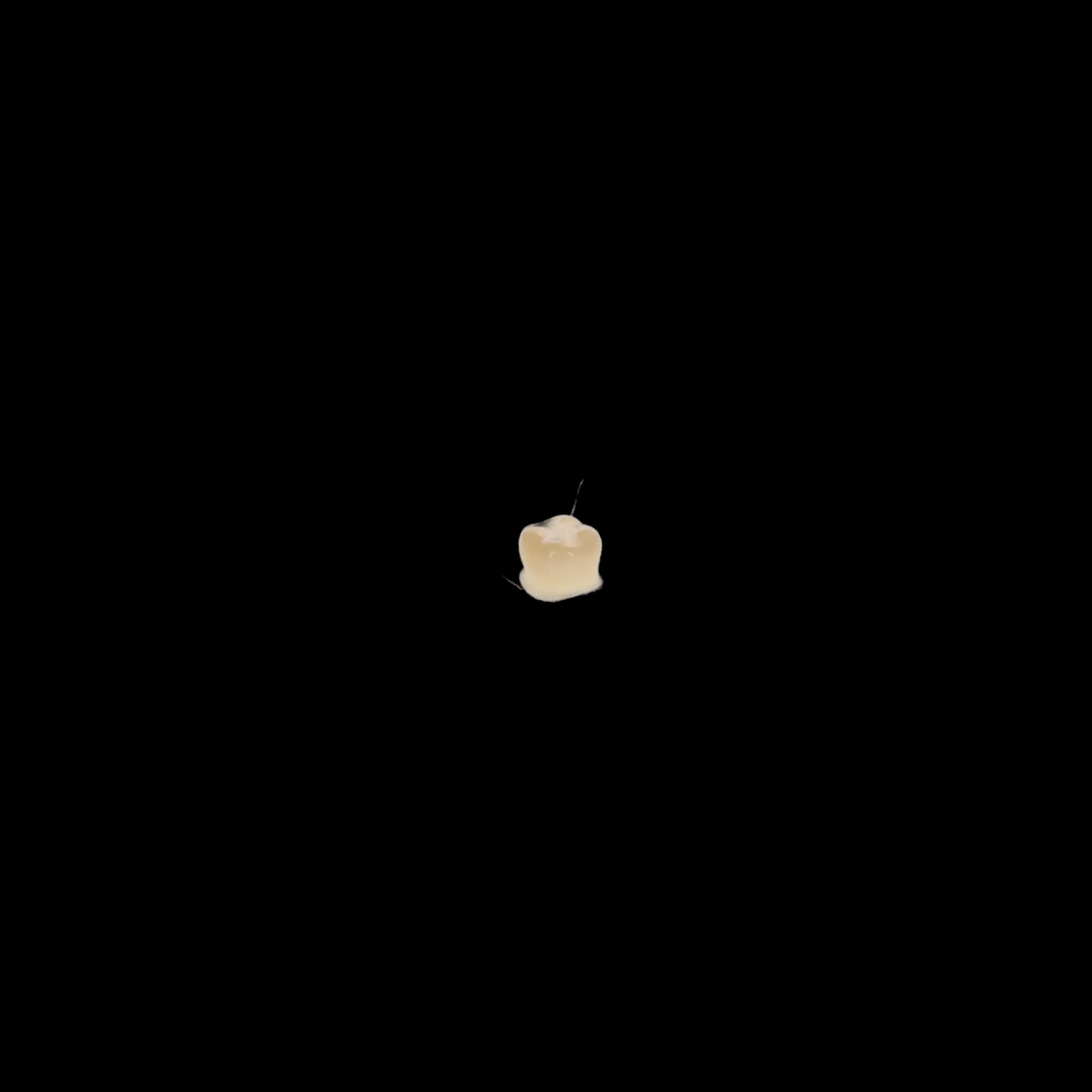 Protemp Crown Temporization Material, Adult Refill, Lower Small Molar, Universal Shade, 5/Pk, 50613 thumbnail 8
