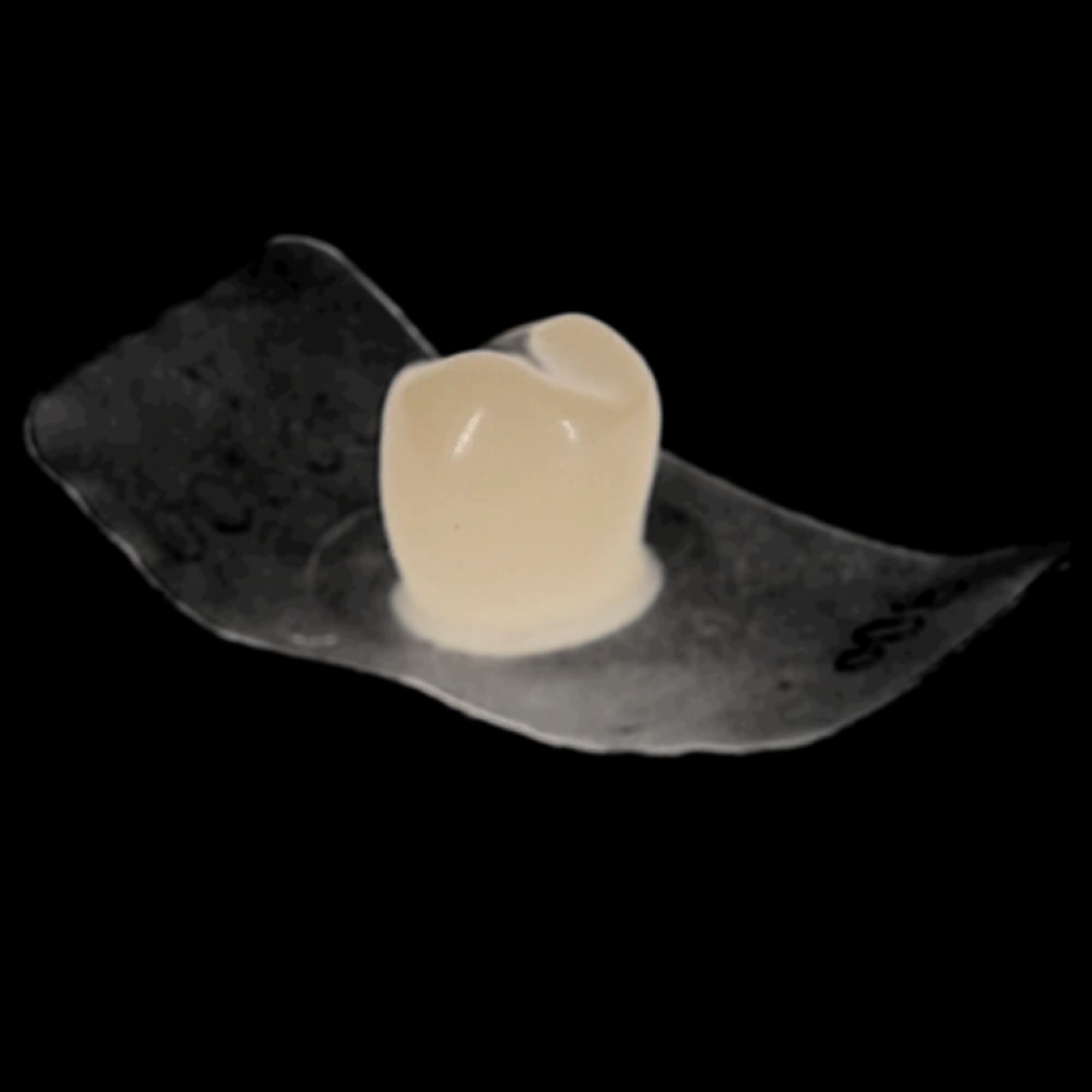 Protemp Crown Temporization Material, Adult Refill, Lower Bicuspid, Universal Shade, 5/Pk, 50616 thumbnail 8