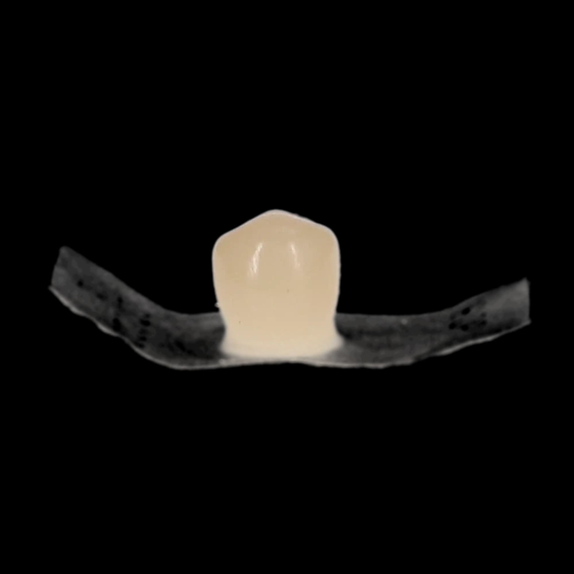 Protemp Crown Temporization Material, Adult Refill, Lower Bicuspid, Universal Shade, 5/Pk, 50616 thumbnail 10