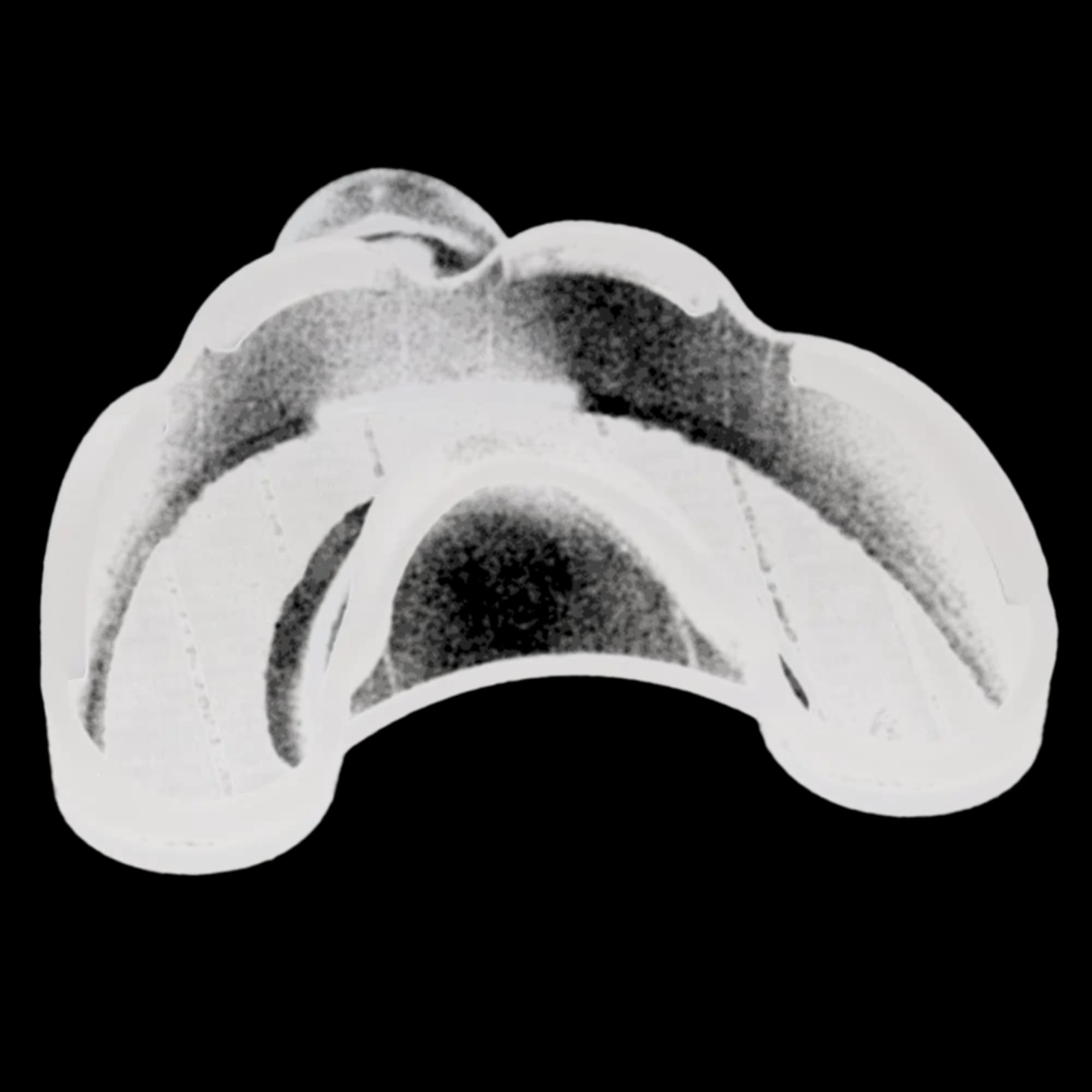 3M Directed Flow Disposable Impression Tray, Upper, Medium, Refill, 10/Pk, 71616 thumbnail 3