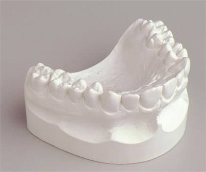 Kerr Snow White Plaster No. 1 Regular Set, Type II Model Plaster, 33 lb, Natural Set, 31001 thumbnail 4