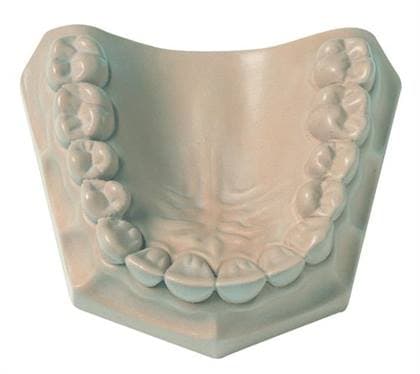 Kulzer Die-Keen Die-Stone, Type IV, Peach, 25 lb Carton, 50046674 thumbnail 7