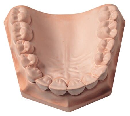 Whip Mix Snap-Stone Type IV Fast-Setting Dental Stone, Pink, 11 lb (5 kg), 23690 thumbnail 3