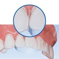 Premier Stop Strip Straight Mylar Anterior Matrix Bands, 10 mm, Blue, 100/Box, 9061375 thumbnail 6