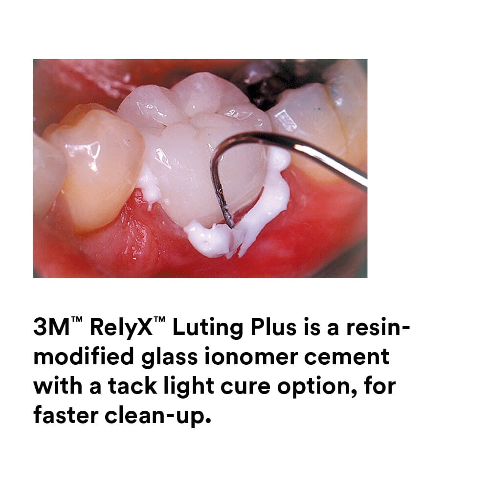 RelyX Luting Plus Automix Resin-Modified Glass Ionomer Cement, Trial Kit, 8.5 g Syringe, 12 Mixing Tips, 3535TK thumbnail 11