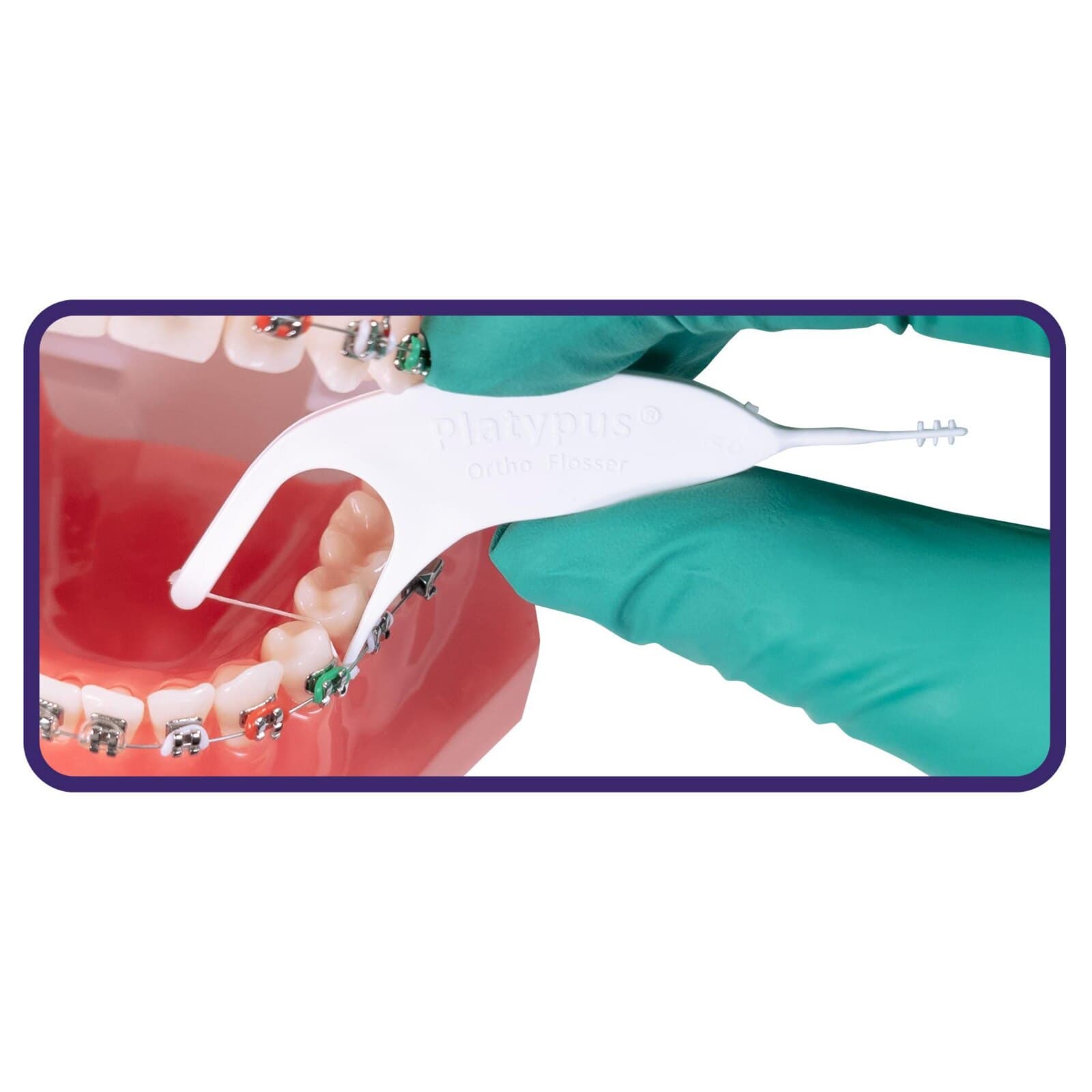 Platypus Orthodontic Flossers, Patient Sampler Pack, 75 Packs of 3 Flossers (225 Total), T103 thumbnail 6