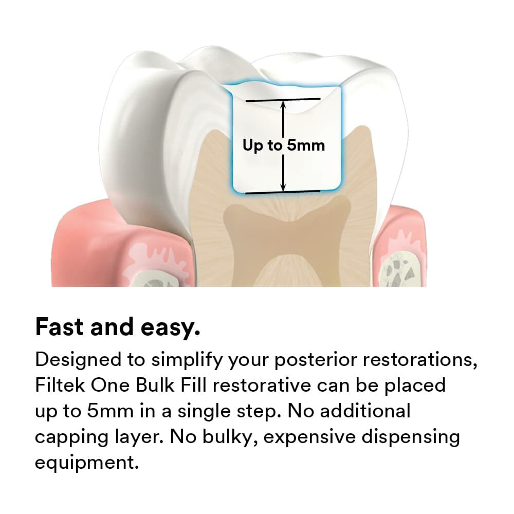 3M Filtek One Bulk Fill Restorative, A1, 4g Syringe Refill, 4866A1 thumbnail 7