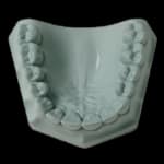 Whip Mix Hard Rock Aqua Die Stone, ISO Type 5, 33 lb (15 kg) Carton, #330001 thumbnail 12
