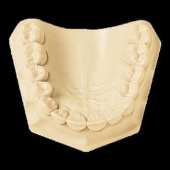 Whip Mix LeanRock Ivory ISO Type 4 Low-Expansion Die Stone, 33 lb (15 kg) Carton, #330030 thumbnail 8