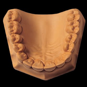 Whip Mix Microstone ISO Type 3 Dental Stone, White, 33 lb (15 kg) Carton, 330055 thumbnail 13