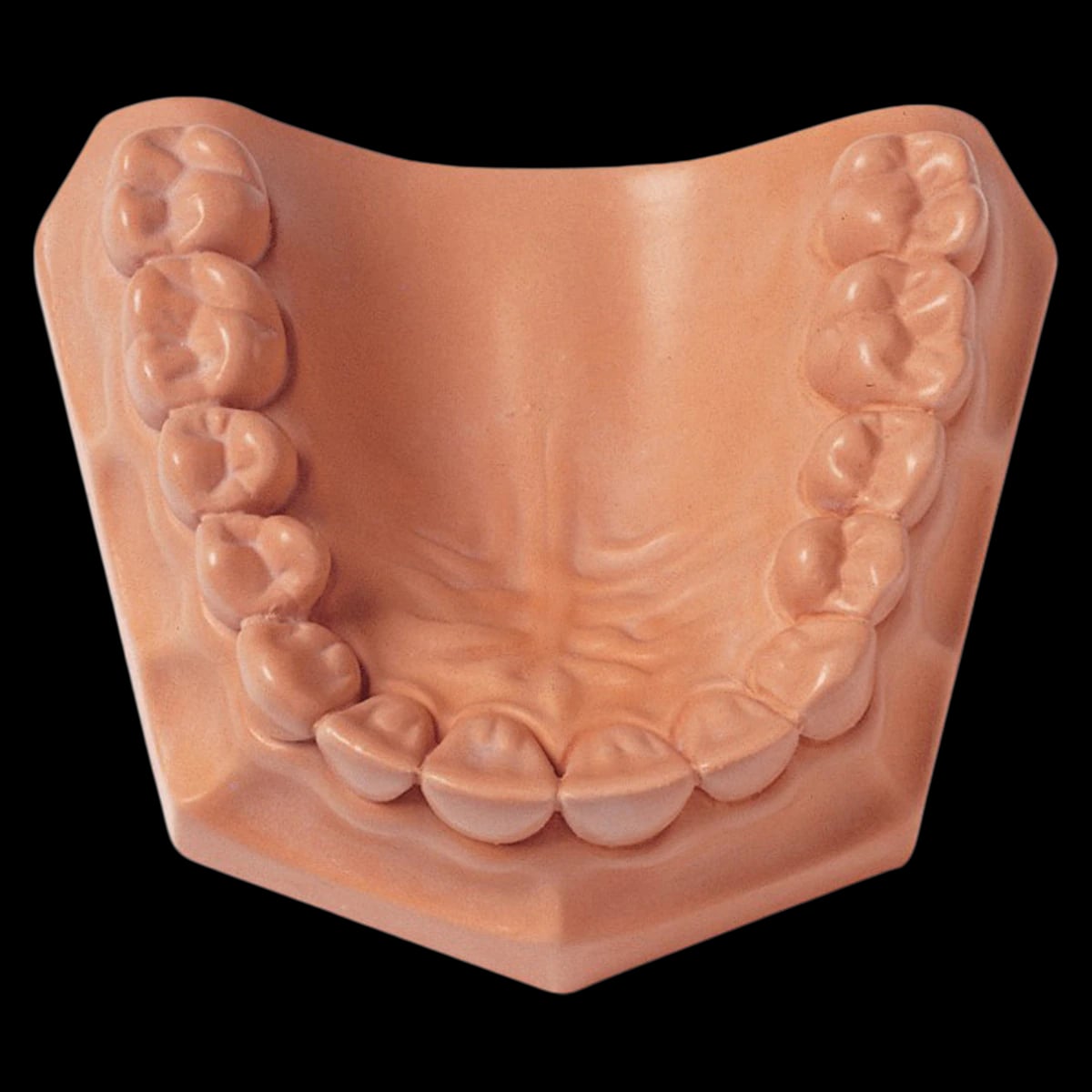 Snap-Stone Fast-Setting Dental Stone, ISO Type 4, Pink, 33 lb (15 kg) Carton, 330080